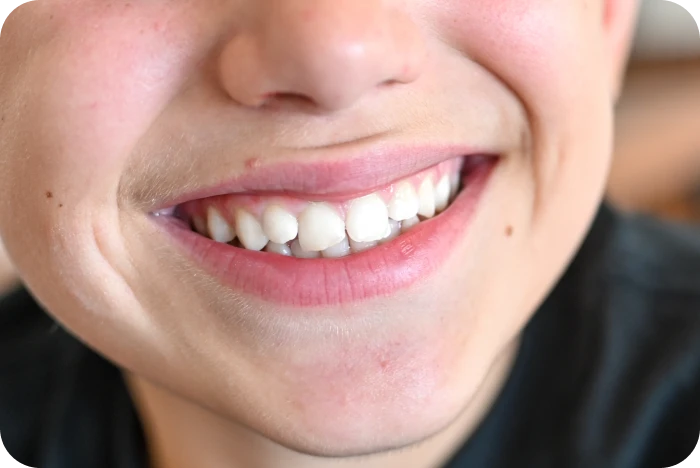 Enfant souriant avec des dents saines