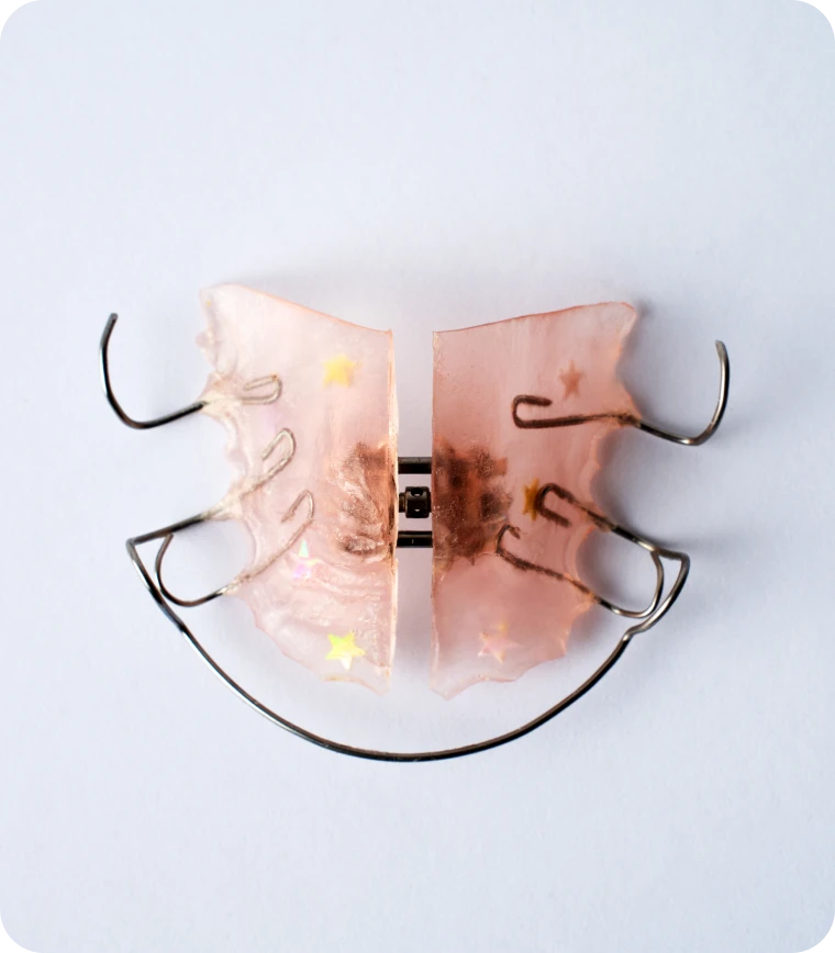 Plaque palatine amovible pour traitement orthodontique
