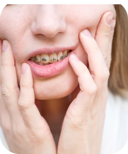 Patiente touchant sa bague dentaire suite à un incident orthodontique